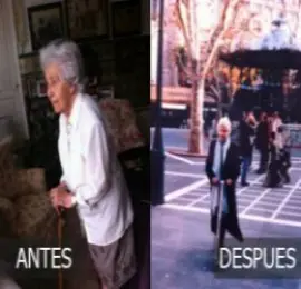 El curioso caso de Soledad López Odriozabala. Sobre osteopatía en hernias discales, osteoporosis y artrosis